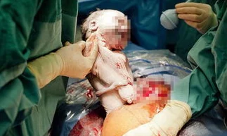 被迫含精受孕入睡h：惊人事件曝光，女性权益再遭侵犯，引发社会广泛关注与讨论！